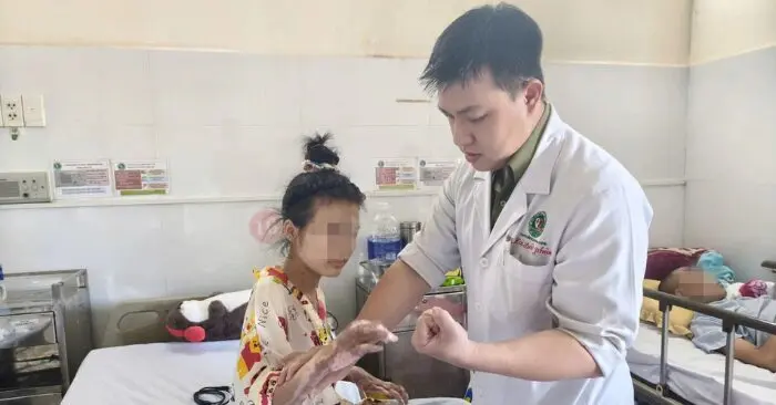 Thiếu nữ bị keo nến đốt cháy toàn thân