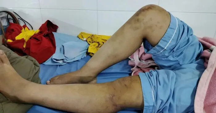 Ba người gia đình bên nội tra tấn bé gái bị bắt