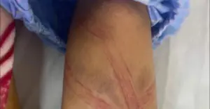 Vụ nữ sinh lớp 7 nghi bị bạo hành vì tiền lợn đất
