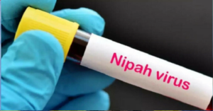 Dấu hiệu nhiễm virus Nipah