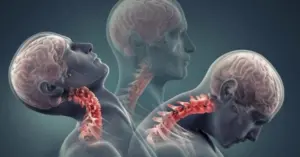 Thói quen của nhiều người Việt bào mòn cột sống cổ