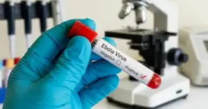 Virus Ebola: Việt Nam chủ động phòng chống nguy cơ dịch bùng phát