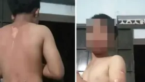 Công an vào cuộc xác minh vụ bé trai ở Đắk Lắk nghi bị mẹ tạt nước sôi gây bỏng, khiến dư luận đặc biệt quan tâm.