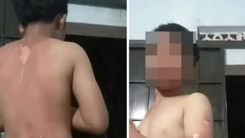 Công an vào cuộc xác minh vụ bé trai ở Đắk Lắk nghi bị mẹ tạt nước sôi gây bỏng, khiến dư luận đặc biệt quan tâm.