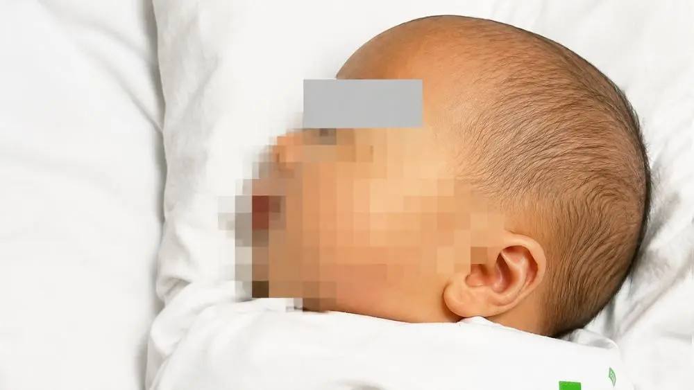 Trẻ sơ sinh bị thủng đại tràng nguy kịch được Bệnh viện Nhi Hải Phòng phẫu thuật kịp thời, cứu sống và đang hồi phục tích cực.
