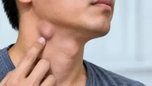 4 dấu hiệu cảnh báo hạch ở cổ là bất thường, giúp nhận biết khi nào tình trạng sưng hạch cần được lưu ý.